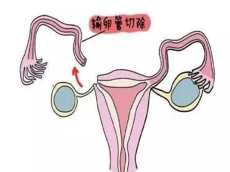 成都代孕包选性别，成都供卵代怀