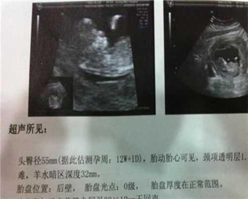 郑州助孕：近视会遗传给宝宝吗孕妇吃什么对胎