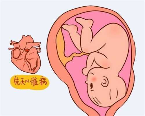 中山代孕产子的流程：【胎儿缺氧，孕妇会有这