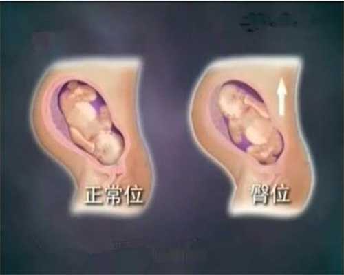 邢台找代孕公司：国外高龄孕妇怀多胞胎，医生