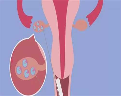 代孕哺乳期女性宜适当补磷