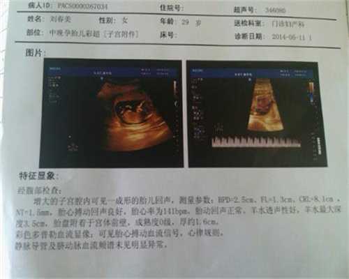 上海第三代试管婴儿可以选女孩吗~上海2020最新代