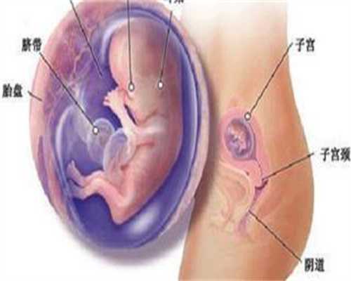 广州公司代孕协议,广州有找过代孕妈妈的吗男性