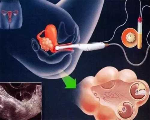 成都代怀孕生殖，美国试管婴儿：“三大使者”助囊胚通过PGS/PGD的检测 